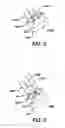 Fig. 03 - SUTURE ANCHOR WITH SUTURE MANAGEMENT