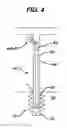 Fig. 04 - SUTURE ANCHOR WITH SUTURE MANAGEMENT