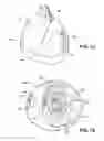 Fig. 07 - Inter-vertebral support kit including main insert jack and dual secondary auxiliary support jacks located between succeeding transverse processes