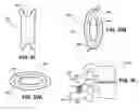 Fig. 15 - Inter-vertebral support kit including main insert jack and dual secondary auxiliary support jacks located between succeeding transverse processes