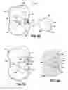 Fig. 22 - Inter-vertebral support kit including main insert jack and dual secondary auxiliary support jacks located between succeeding transverse processes
