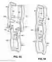 Fig. 35 - Inter-vertebral support kit including main insert jack and dual secondary auxiliary support jacks located between succeeding transverse processes