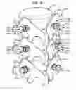 Fig. 03 - COMPOUND SPINAL ROD AND METHOD FOR DYNAMIC STABILIZATION OF THE SPINE
