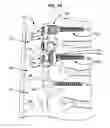 Fig. 04 - COMPOUND SPINAL ROD AND METHOD FOR DYNAMIC STABILIZATION OF THE SPINE