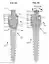 Fig. 06 - COMPOUND SPINAL ROD AND METHOD FOR DYNAMIC STABILIZATION OF THE SPINE