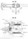 Fig. 13 - COMPOUND SPINAL ROD AND METHOD FOR DYNAMIC STABILIZATION OF THE SPINE