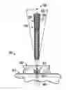 Fig. 01 - Fastener with serrated thread for attachment to a bone plate at a selectable angle