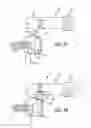 Fig. 04 - System and method for facilitating repair and reattachment of comminuted bone portions