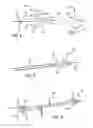 Fig. 06 - System and method for facilitating repair and reattachment of comminuted bone portions