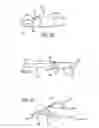 Fig. 07 - System and method for facilitating repair and reattachment of comminuted bone portions