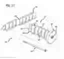 Fig. 09 - System and method for facilitating repair and reattachment of comminuted bone portions