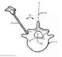 Fig. 01 - Implanting facet joint screws percutaneously