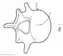 Fig. 02 - Implanting facet joint screws percutaneously