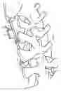 Fig. 09 - Implanting facet joint screws percutaneously