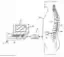 Fig. 01 - TISSUE STIMULATION SYSTEM AND METHOD WITH ANATOMY AND PHYSIOLOGY DRIVEN PROGRAMMING