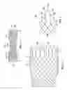 Fig. 02 - Soft crowns