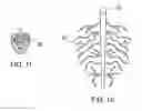 Fig. 06 - Method of treating atherosclerotic occlusive disease