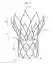 Fig. 04 - Assembly and method for loading a self-expanding collapsible heart valve