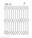 Fig. 08 - Expandable sheath for introducing an endovascular delivery device into a body