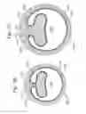 Fig. 28 - Expandable sheath for introducing an endovascular delivery device into a body