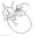 Fig. 01 - Prosthetic valve for transluminal delivery