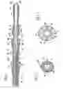 Fig. 02 - Prosthetic valve for transluminal delivery