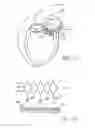 Fig. 08 - Prosthetic valve for transluminal delivery
