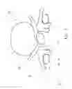 Fig. 02 - SPINAL IMPLANT STRUCTURE AND METHOD FOR MANUFACTURING THE SAME