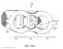 Fig. 41 - SYSTEM AND METHOD FOR SACRO-ILIAC STABILIZATION