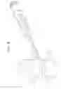 Fig. 16 - Method of inserting surgical implant with guiding rail