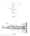 Fig. 06 - Intervertebral device and methods of use
