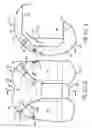 Fig. 07 - Knee arthroplasty prosthesis