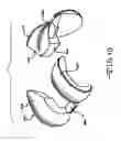 Fig. 09 - Knee arthroplasty prosthesis