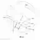 Fig. 22 - Prosthetic ball-and-socket joint