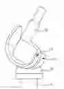Fig. 01 - PROSTHESIS COMPONENT WITH ANTIMICROBIALLY COATED SLIDING SURFACE