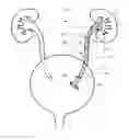 Fig. 01 - Ureteral stent