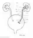 Fig. 03 - Ureteral stent