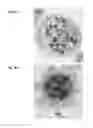 Fig. 17 - Enhanced microfluidic electromagnetic measurements