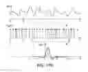 Fig. 48 - Systems And Methods Of Channel Identification Machines For Channels With Asynchronous Sampling