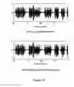 Fig. 15 - Noise cancellation device for communications in high noise environments