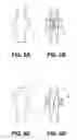 Fig. 06 - Method and system for design of a reticle to be manufactured using variable shaped beam lithography