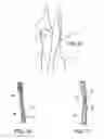 Fig. 09 - Body-shaping intimacy garment