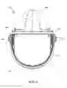 Fig. 04 - Weight balancing face shield