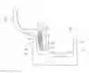 Fig. 01 - Locking device