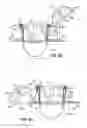 Fig. 16 - UNIVERSAL CASKET AND VAULT LIFTING AND LOWERING DEVICE