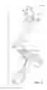 Fig. 03 - Inner Type Tracheostomy Tube