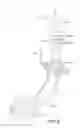 Fig. 07 - Inner Type Tracheostomy Tube