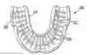 Fig. 01 - Mouthguard