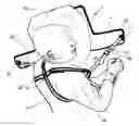 Fig. 01 - DEVICE FOR IMPEDING A PERSON FROM ASSUMING A SUPINE POSITION