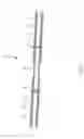 Fig. 09 - Adjustable tarpaulin support